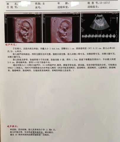 journal_insert_pic_1674882199