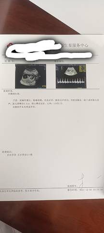 journal_insert_pic_1677581790