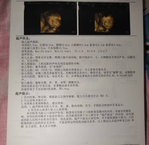 journal_insert_pic_1719428339