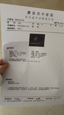 journal_insert_pic_1677521126