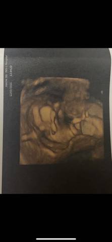 journal_insert_pic_1688419017