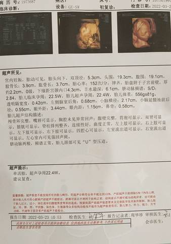 journal_insert_pic_1740899049