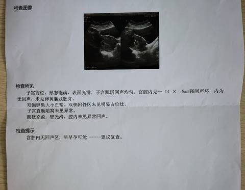 journal_insert_pic_1680171792