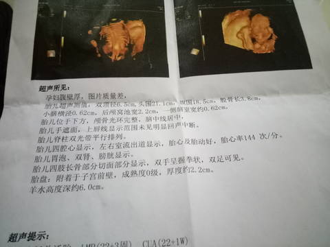 journal_insert_pic_1674889511