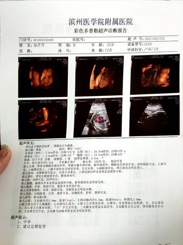 journal_insert_pic_1677579022