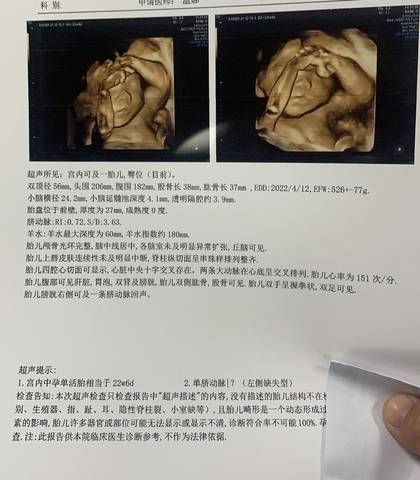 journal_insert_pic_1681203925
