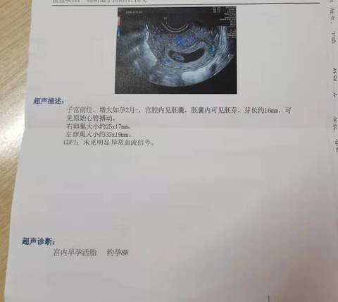 journal_insert_pic_1684325070