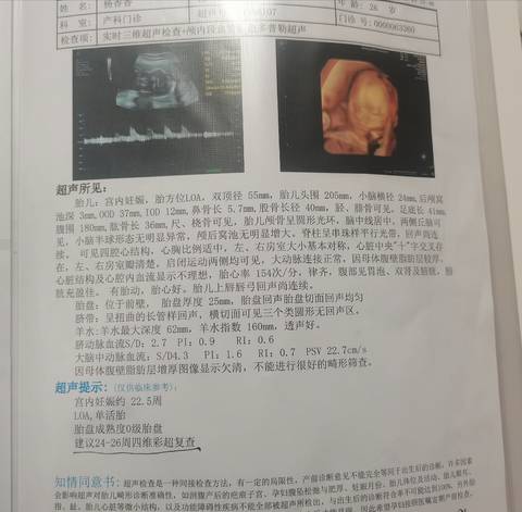 journal_insert_pic_1679300289