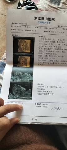 journal_insert_pic_1676674467