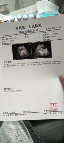 journal_insert_pic_1681622132