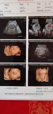 journal_insert_pic_1719681887