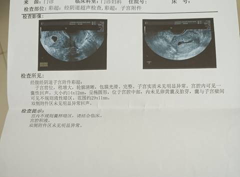 journal_insert_pic_1740950811