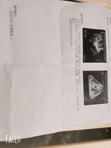 journal_insert_pic_1686903698