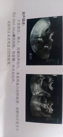 journal_insert_pic_1741013521