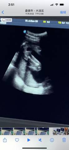 journal_insert_pic_1677719809