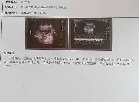 journal_insert_pic_1676662686