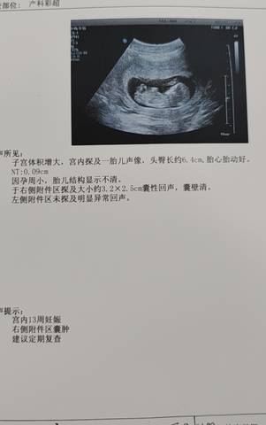 journal_insert_pic_1740897307