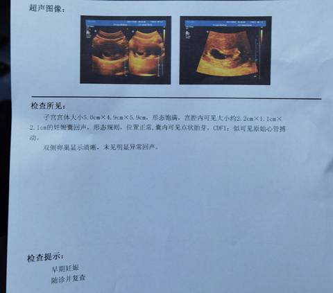 journal_insert_pic_1685452825