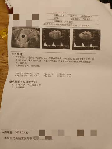 journal_insert_pic_1740828528