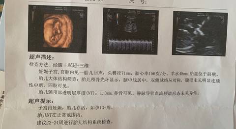 journal_insert_pic_1676432286