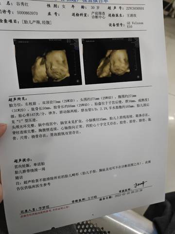 journal_insert_pic_1719679182