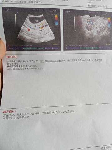 journal_insert_pic_1683535401