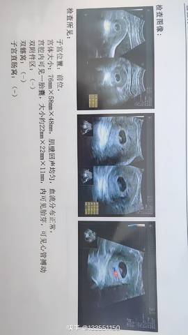 journal_insert_pic_1685777388