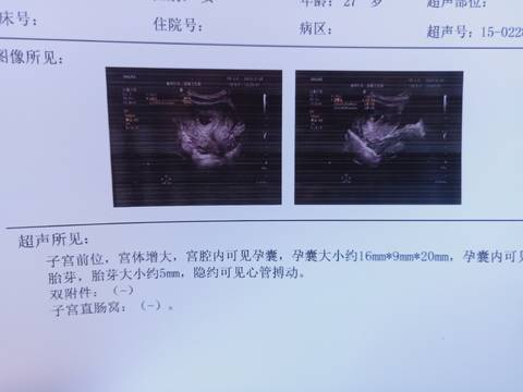 journal_insert_pic_1719643147