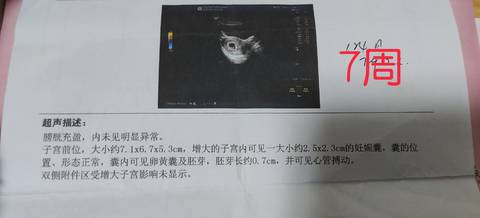 journal_insert_pic_1679196801
