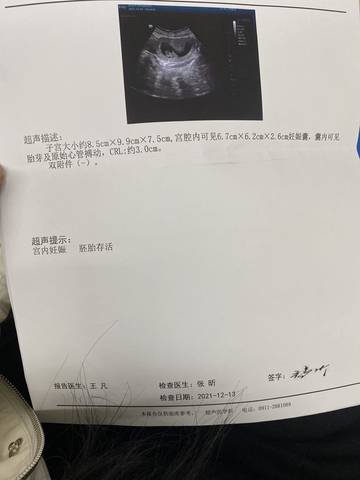 journal_insert_pic_1679183988