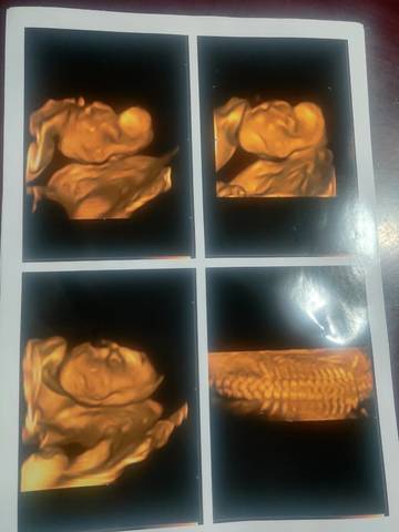 journal_insert_pic_1684515835