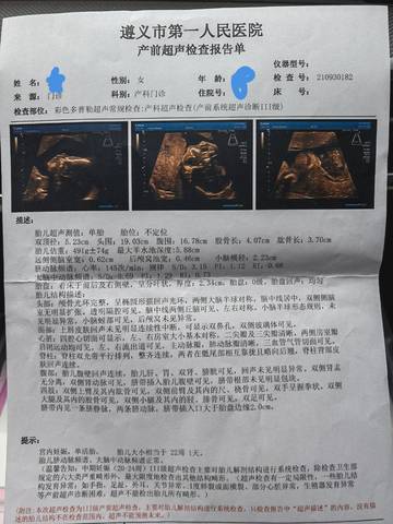 journal_insert_pic_1682154689