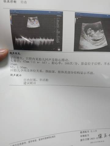 journal_insert_pic_1681361785