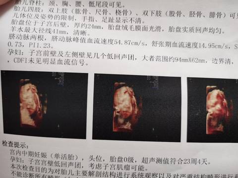 journal_insert_pic_1719871295