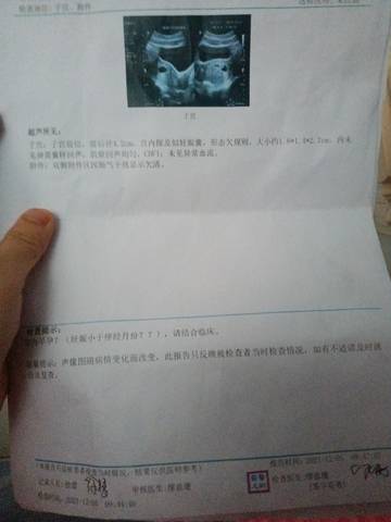 journal_insert_pic_1674157413