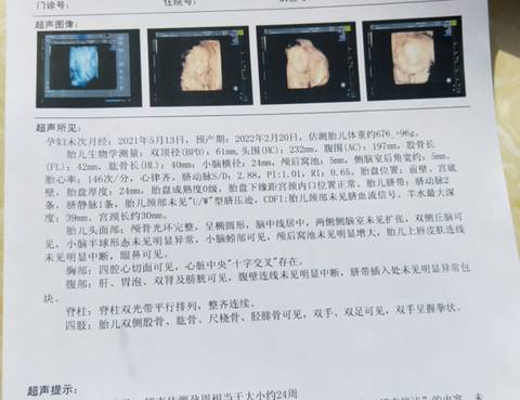 journal_insert_pic_1686885405