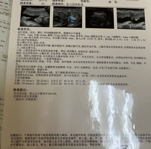 journal_insert_pic_1684499958