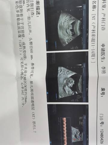 journal_insert_pic_1679862757
