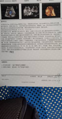 journal_insert_pic_1678223195