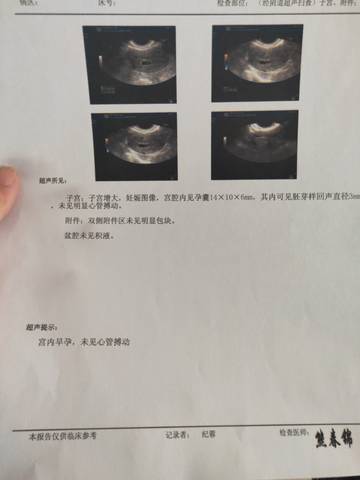 journal_insert_pic_1686299664