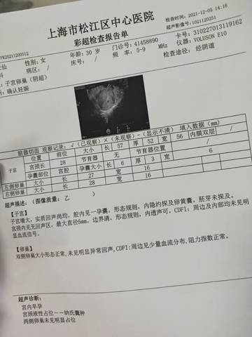 journal_insert_pic_1675328971