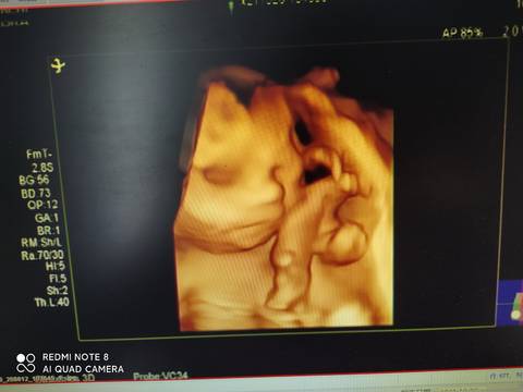 journal_insert_pic_1683086904