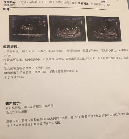 journal_insert_pic_1685435146