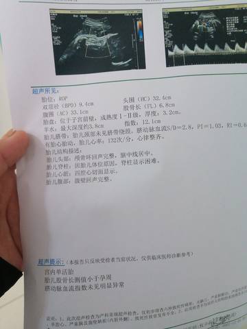 journal_insert_pic_1676626037