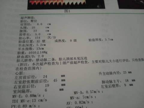 journal_insert_pic_1688418038
