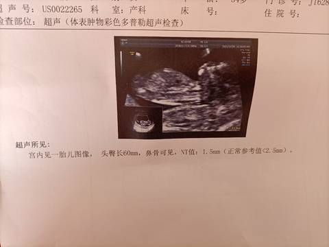 journal_insert_pic_1683023325