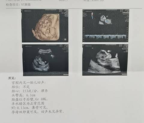 journal_insert_pic_1675944863