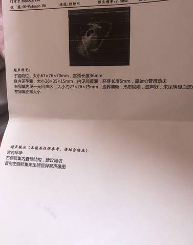 journal_insert_pic_1686204264