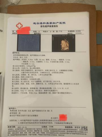 journal_insert_pic_1690247234
