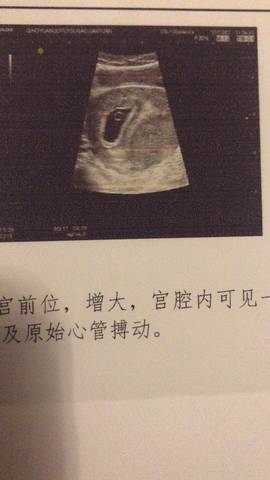journal_insert_pic_1683614373